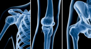 Depiction of joints treated in Spokane orthopedics services